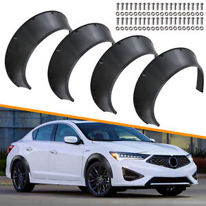 Car Fender Flares Fits for Acura ILX RSX TL Wheel Arches Extended Wide Body Kit 