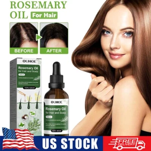 Organic Rosemary Essential Oil for Hair Growth & Skin Care, 100% Pure & Natural - Picture 1 of 7