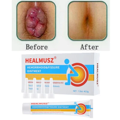 HEALMUSZ Hemorrhoid Cream, Hemorrhoid Treatment, Hemorrhoid & Fissure Ointment