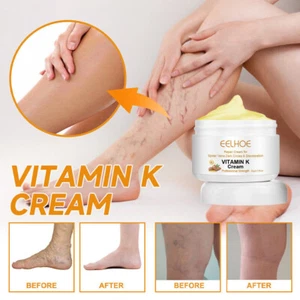 60g Vitamin K Cream Spider Varicose Veins Scars Rosacea Capillaries Dark Circles - Picture 1 of 12