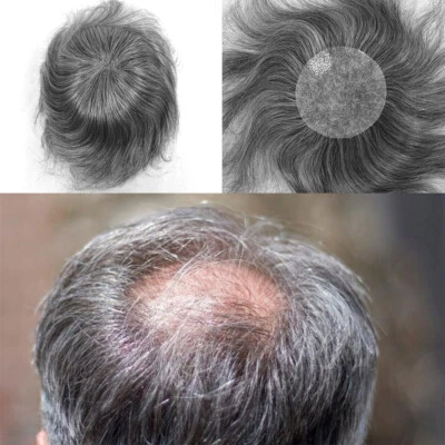 Parches de cabello grises de piel delgada con manchas calvas toupee para hombres cabello humano 8x8 cm Foto 1 de 4