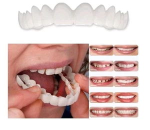 Snap On Smile Veneers Adjustable Upper & Lower Cosmetic Teeth Fake Temporary - Picture 1 of 8