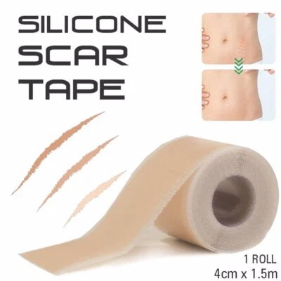 Body Assist - Silicone Scar Tape Medical Grade Scar Therapy 1 ROLL 4cm X 1.5m - Image 1 of 4
