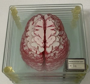 Anatomic Brain Specimen Coasters (Set of 10) - Picture 1 of 12