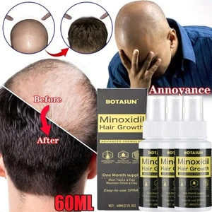 3Pcs Minoxidil 5% Extra Strength for Men Hair Regrowth Treatment Spray Solution - Bild 1 von 18