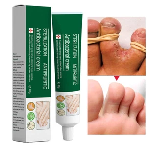 Hand-Foot Moisturizing And Repairing Ointment For Eliminating Foot Fungi - Picture 1 of 12