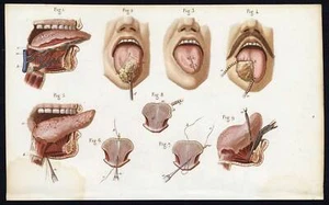 Kuriositätenkabinett Tafel Poster A3 menschliche Anatomie Chirurgie Nr.13 Sprache - Bild 1 von 1