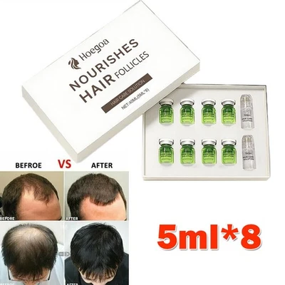8Pcs Advanced Hair Growth Treatment Ginseng Hair Regrowth System Solution Set - Image 1 of 4