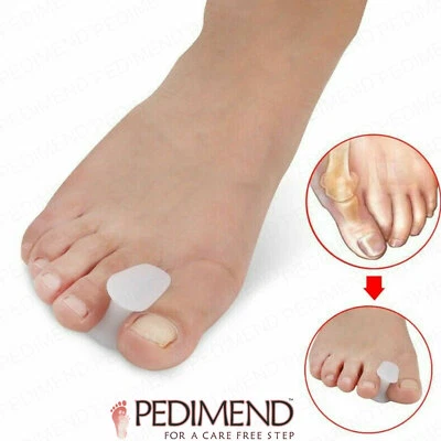 Pedimend 4PC Silicone Gel Toe Separator Overlapping Toes & Correct Toe Alignment