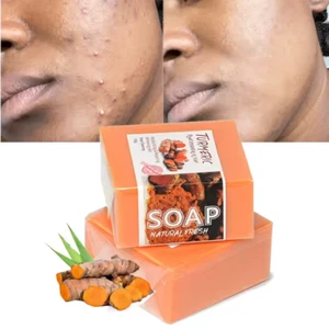 2PCS handmade tumeric bar soap bath anti acne dark spots removal and whitening. - Picture 1 of 7