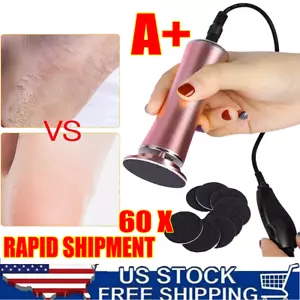Electric Foot File Callus Remover Dead Skin Removal Foot Grinder Pedicure Tool - Picture 1 of 16