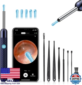 Juego de herramientas de limpieza de cera de oído 1080P, 8 piezas con cuchara y cámara, compatible con iO - Imagen 1 de 6