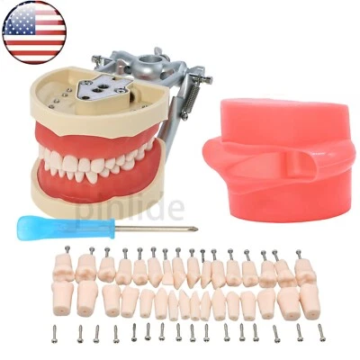 US Kilgore NISSIN 200 Type Dental Typodont Teeth Model with Removable Teeth - Image 1 of 4