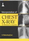 Interpretation Of Chest X Ray  An Illustrated Companion Paperback By Balach
