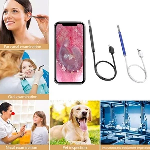 1Set Smart Visual Earpick Endoscope Spoon Ear Cleaner Camera Otoscope Ear Wax - Picture 1 of 16