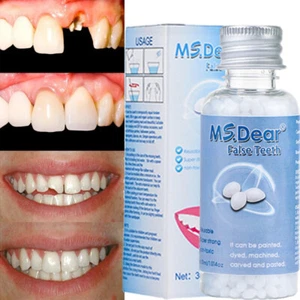Tooth Repair Granules Temporary Kit Fitting Beads Reusable Moldable False Teeth- - Picture 1 of 23