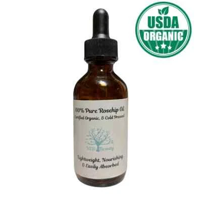 Rosehip Oil USDA Certified Organic 100% Pure – Face, Hair, Body - Cold Pressed - Image 1 of 4