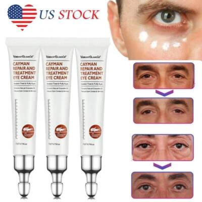 3 bolsas de ojos crema para eliminar instantáneamente ojeras reafirmante antiarrugas ojeras Foto 1 de 4