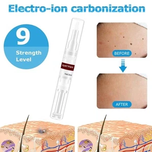 3ml Skin Tag Remover Wart Remover Liquid Quickly Remove Common And Plantar W BAK - Bild 1 von 11