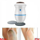 Electric Vacuum Foot File - Adsorption Grinder USB Electronic Callus Remover USA