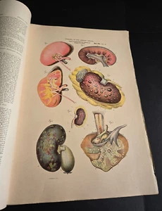 Antique 1884 Pathological Anatomy Diseases of Human Body J. A. Jeancon Progress - Bild 1 von 23