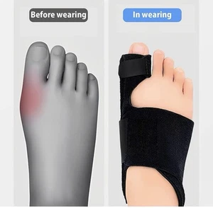 Corrector de juanete-espaciadores de dedos separador de dedos grandes separador alisador para mujeres y hombres - Imagen 1 de 4