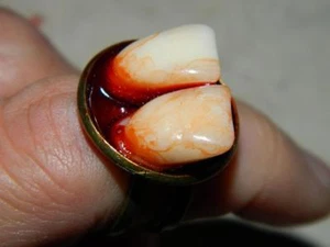 Halloween Horror Requisite - realistischer gruseliger Ring meiner zwei vorderen Zähne - Bild 1 von 1