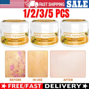 1-5PCS New Cvreoz Bee Venom Cream, 30g New Zealand Bee Venom Cream 30g