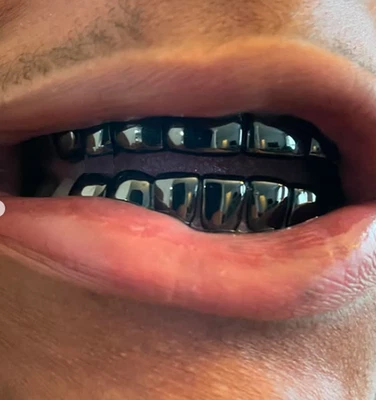 Black Gunmetal Removeable Mouth Teeth Grillz Upper & Lower Set + Molds - Image 1 of 4