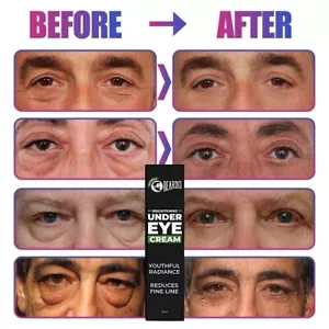 Beardo Under Eye Cream Serum Lifting Anti Aging Bags Remove Wrinkle Puffy Skins - Bild 1 von 5