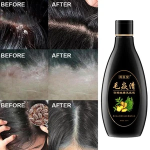 200ml Scalp Hair Follicle Shampoo Antibacterial Anti-Itching Oil Control L8E6 - Picture 1 of 11