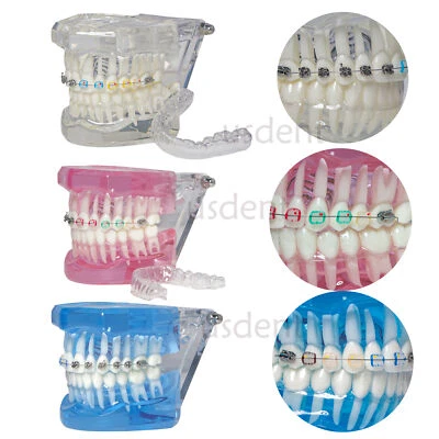 Orthodontic Dental Teeth Model Ceramic Metal Self-ligating Bracket Buccal Tube - Image 1 of 4