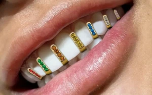 Custom 14K Gold Plated Iced CZ Upper Teeth Gap Grillz 7pc Set with Mold Kit USA - Picture 1 of 3