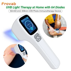 308nm uvb excimer blue light treatment device for skin disorders home therapy - Picture 1 of 12