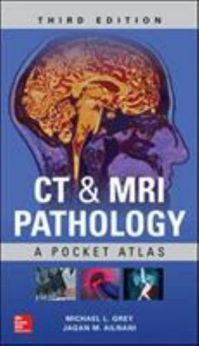 CT & MRI Pathology: a Pocket Atlas, Third Edition by Michael L. Grey and Jagan Mohan Ailinani (2018, Trade Paperback)