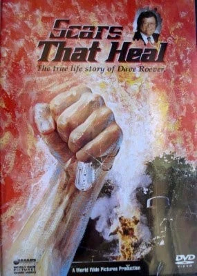 Scars That Heal (The True Life Story of Dave Roever) Foto 1 de 1