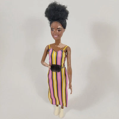 Barbie Fashionistas Pequeña Afroamericana AA 135 PIEL DE VITILIGO Afro Natural Foto 1 de 4