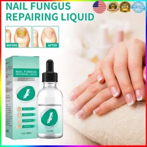 Kerassentials per Unghie Funghi Kerassentials Olio Trattamento Funghi Unghie - Foto 1 di 14