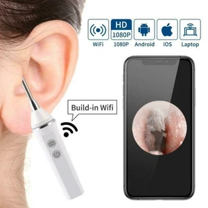 Ear Endoscope WIFI 3.9mm Focal Lens 1.5cm 5MP Mouth Ear Scope Camera Black Color - Picture 1 of 9