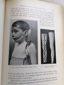 MANUAL & ATLAS OF ORTHOPEDIC SURGERY - pathology prophylaxis YOUNG pre WWI 1911 - Picture 1 of 15