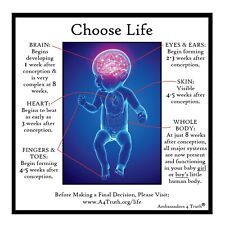 Choose Life | Gospel Tracts | Bible Tracts | Post Card Size (5"x5") | Pack of 50