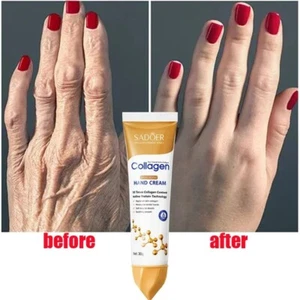 Crema Curativa de Manos Antiarrugas Restaura Tu Piel REJUVENECE Tus Manos 50%OFF - Picture 1 of 7