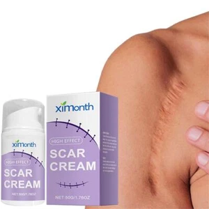 ❀50 g Gel para eliminar cicatrices y marcas de acné Pomada para eliminar cicatrices quemaduras estrías - Imagen 1 de 11