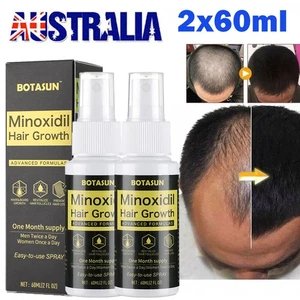2 Pack Extra Strength Men Hair Regrowth Treatment Topical Solution Month Supply - Bild 1 von 19