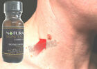Homeopathic Organic Skin Tag Wart Mole Remover Quita Verrugas Removedor Verruga  Only $13.99 on eBay