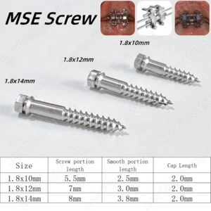 Tornillos MSE Tornillo de Expansión Dental Facial Dividido Rápido Maxilar Expansor Esquelético - Imagen 1 de 15