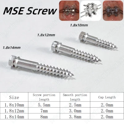 Tornillos MSE Tornillo de Expansión Dental Facial Dividido Rápido Maxilar Expansor Esquelético Foto 1 de 4