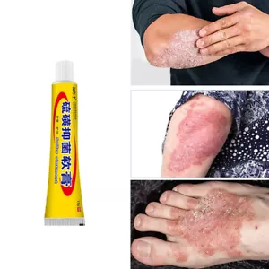 Sulfur Antibacterial Cream Body Skin Care Eczema Anti-itch Relief Rash Urticaria - Picture 1 of 11