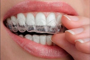 Very Strong Teeth Whitening Refill Gel No:36 Professional Grade, Strong 3ml