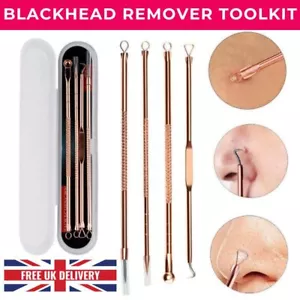 BLACKHEAD ACNE POPPER SPOT PIMPLE COMEDONE WHITEHEAD REMOVER EXTRACTOR FACE TOOL - Picture 1 of 12